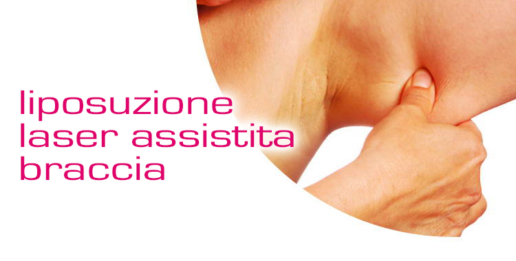 trattamento lifting laser mirato alle braccia